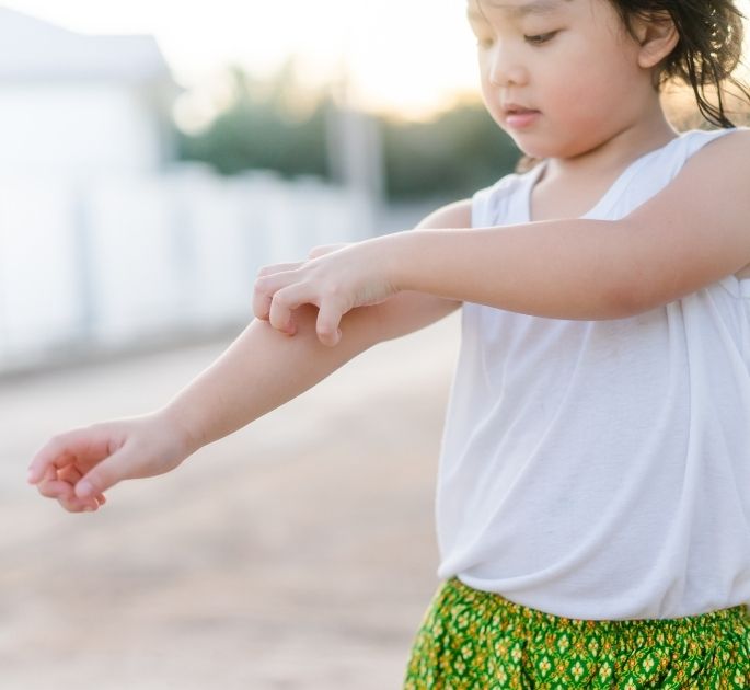 Come proteggere i bambini dalle punture di zanzara