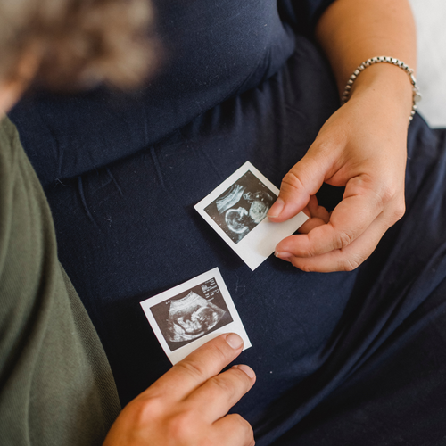 5 Cose che avrei voluto sapere quando ero incinta - Mustela Italia - 1