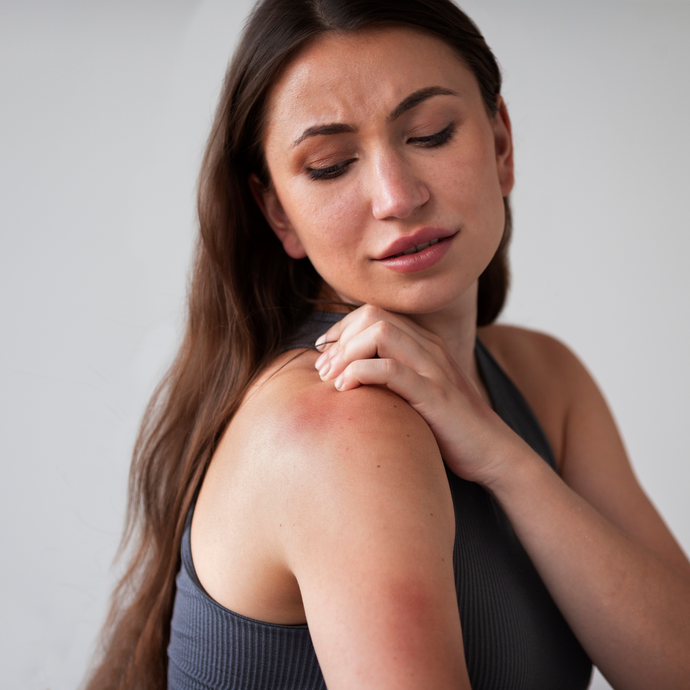 Come alleviare e trattare il prurito legato all'eczema atopico
