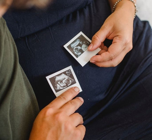 Tutto quello che devi sapere sulle gravidanze multiple - Mustela Italia - 1