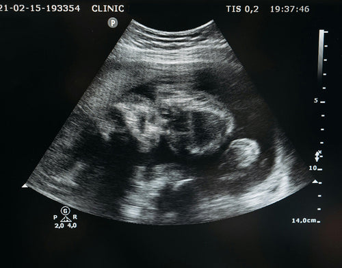 Maschio o femmina: i 5 nomi più belli del mondo - Mustela Italia - 1