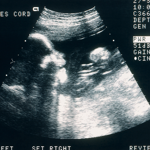 Alcol in gravidanza: quali conseguenze? - Mustela Italia - 1