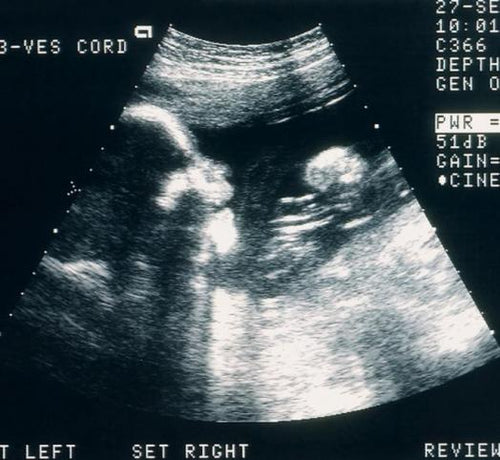 I rischi del consumo di alcol e fumo in gravidanza - Mustela Italia - 1