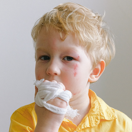 atopic2 - Mustela Italia - 1