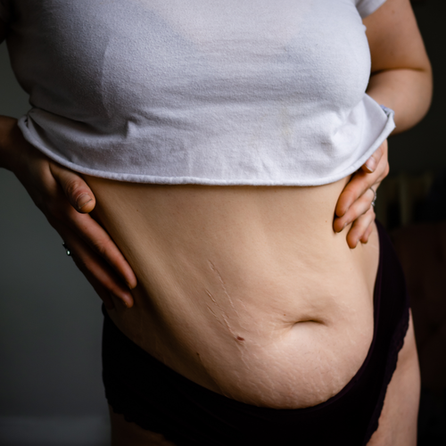 Corpo in gravidanza: come accettare i cambiamenti prima e dopo il parto - Mustela Italia - 1