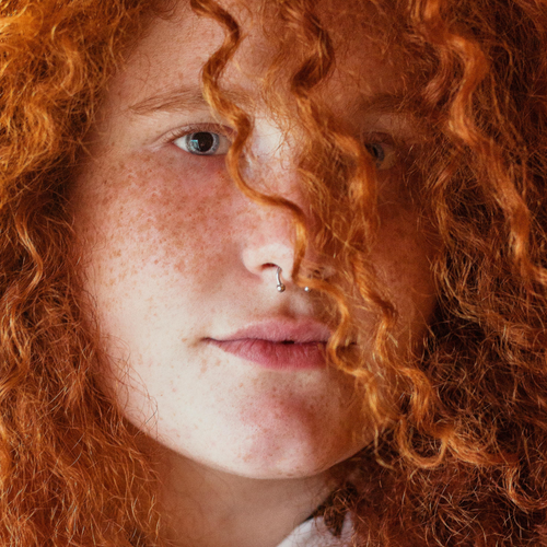 Come lenire la pelle ipersensibile - Mustela Italia - 1