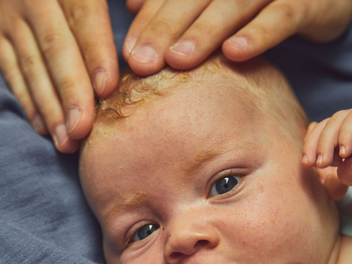 HEADER_COLLEZIONI_CROSTA - Mustela Italia - 1