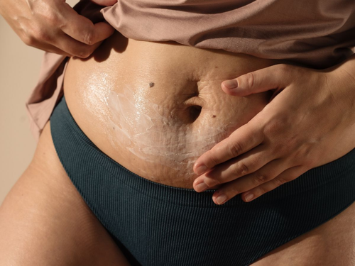 HEADER_COLLEZIONI_SMAGLIATURE_d666ce48-0711-4ef3-97c7-6168ec7d1f94 - Mustela Italia - 1